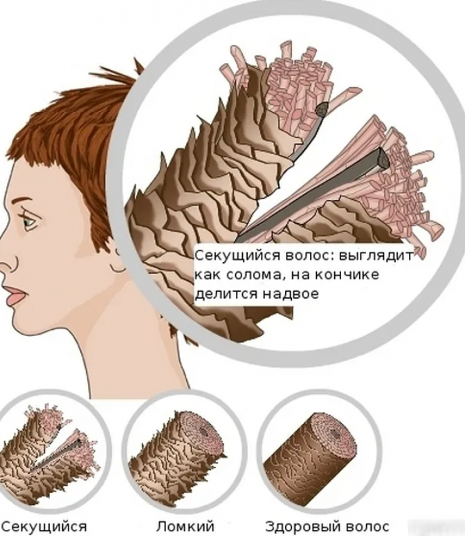 Что делать, если сильно секутся волосы по всей длине? Способы восстановления секущихся волос и правила профилактики проблемы